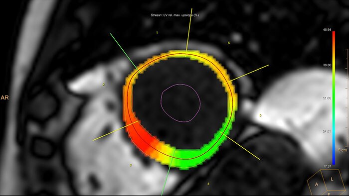 cardiac temporal enhancement thumbnail