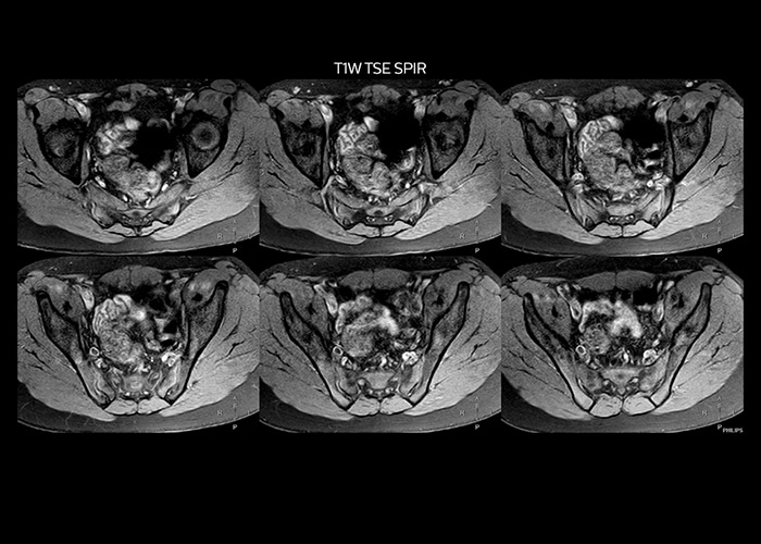 clinical cases tab2 image