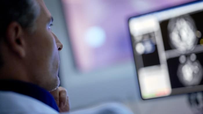 Understanding how Compressed SENSE makes MRI faster